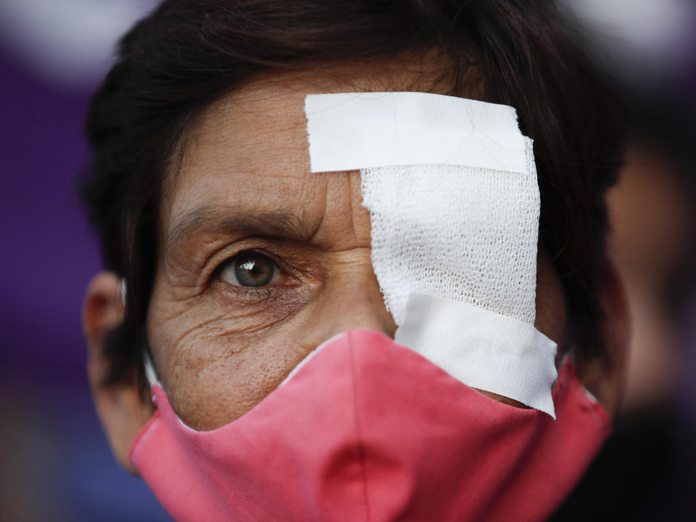 A woman has one eye covered to protest gender violence, in Buenos Aires, on Feb. 17, 2021. Women from the 