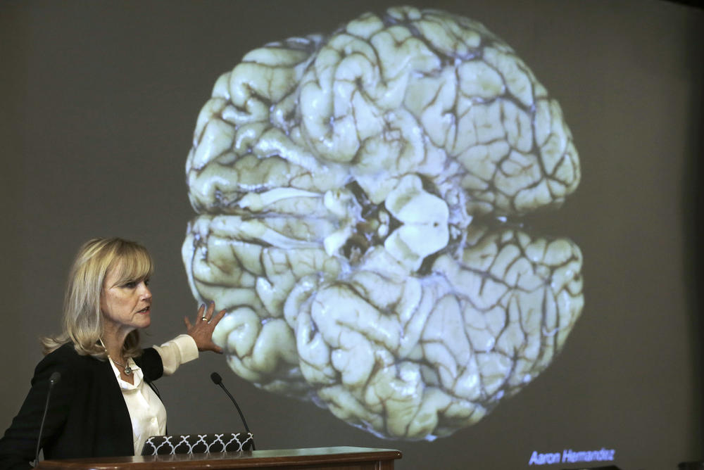 Dr. Ann McKee, a neuropathologist who directs Boston University's CTE Center, speaks about NFL player Aaron Hernandez's brain, projected on a screen behind her. He was diagnosed posthumously with CTE.
