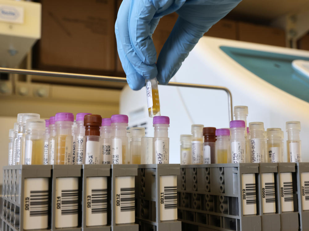 Researchers at the University of Washington Medicine Retrovirology Lab at Harborview Medical Center in Seattle process samples from Novavax's phase 3 COVID-19 vaccine clinical trial in February 2021.