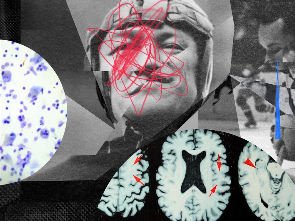 The degenerative brain condition CTE can be diagnosed only through autopsy. But there's a quiet population of everyday people afraid they have it — and they're turning to dubious treatments.