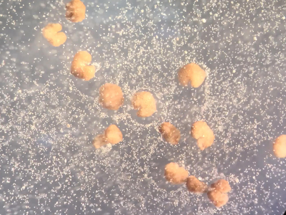 A dozen organisms designed by artificial intelligence known as xenobots (C-shaped; beige) beside loose frog stem cells (white).