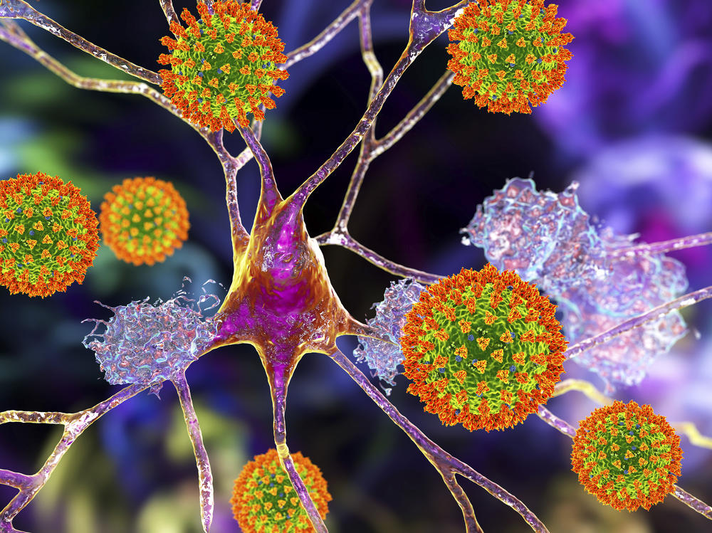Researchers are learning that the coronavirus can infect neurons and may cause lasting damage in some cases.