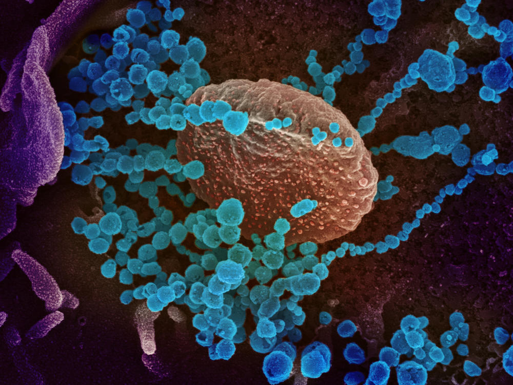 A colorized scanning-electron-microscope image shows SARS-CoV-2 (the round blue objects) emerging from cells cultured in the lab. SARS-CoV-2 is the coronavirus that causes the disease COVID-19.