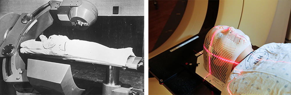 Left: A patient receives a Cobalt 60 cancer therapy in 1951. Right: Lasers are used to position a patient model wearing a short face mask in a computed tomography (CT) scanner to obtain images of a tumor before radiation therapy July 29, 2010.