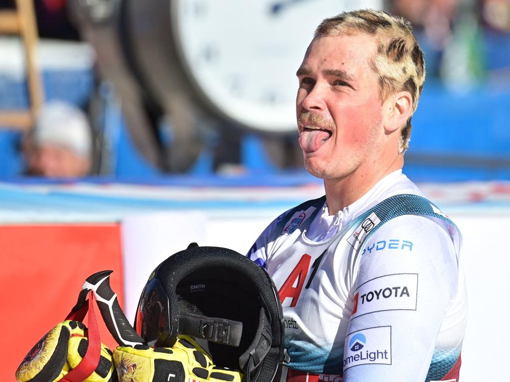 U.S. alpine skier River Radamus dyed his hair into a snow leopard pattern ahead of the men's Giant Slalom event during the FIS Ski Alpine World Cup in Soelden, Austria.