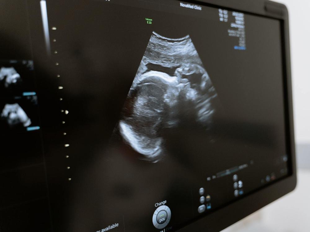 Vaccinating pregnant women against the coronavirus also helps protect their babies against COVID-19 after they are born,  according to new research.