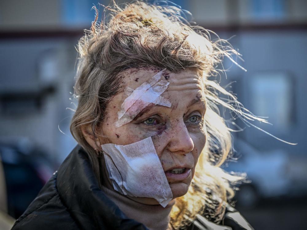 A wounded woman stands outside a hospital after the bombing of the eastern Ukraine town of Chuhuiv on Thursday.