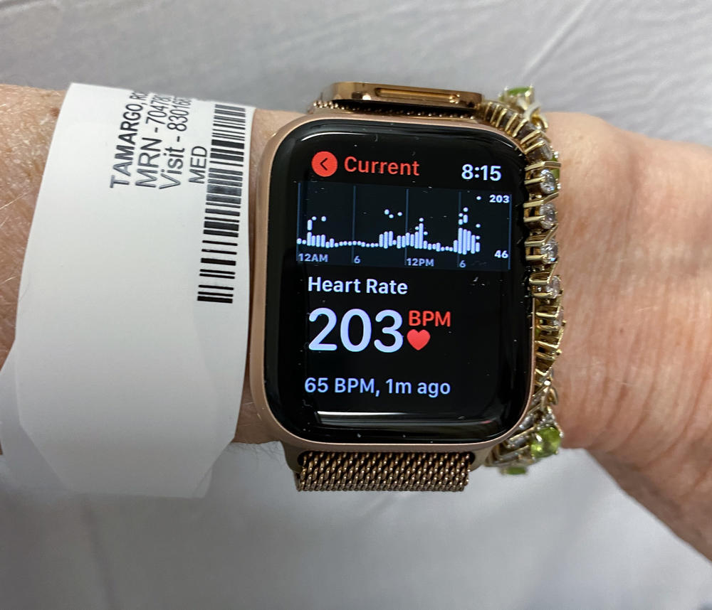 Robi Tamargo wears a smart watch to monitor her heart rate and other vital signs since she has had cardiac complications due to COVID-19. She has <a href=