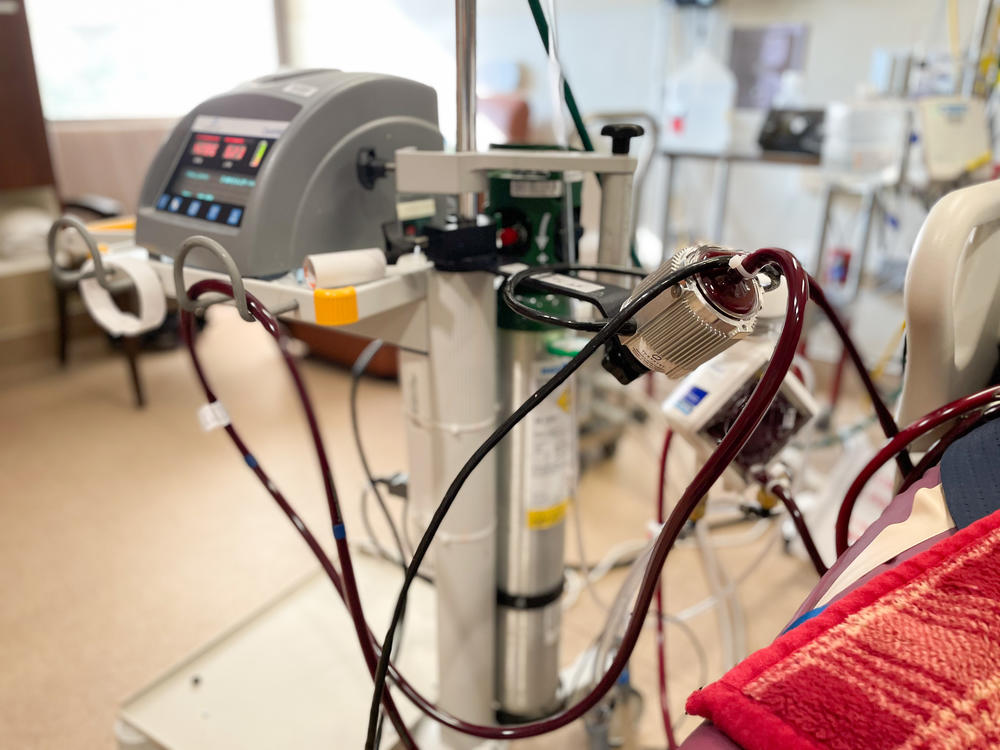 ECMO machine at Ascension Saint Thomas in Nashville during the delta surge