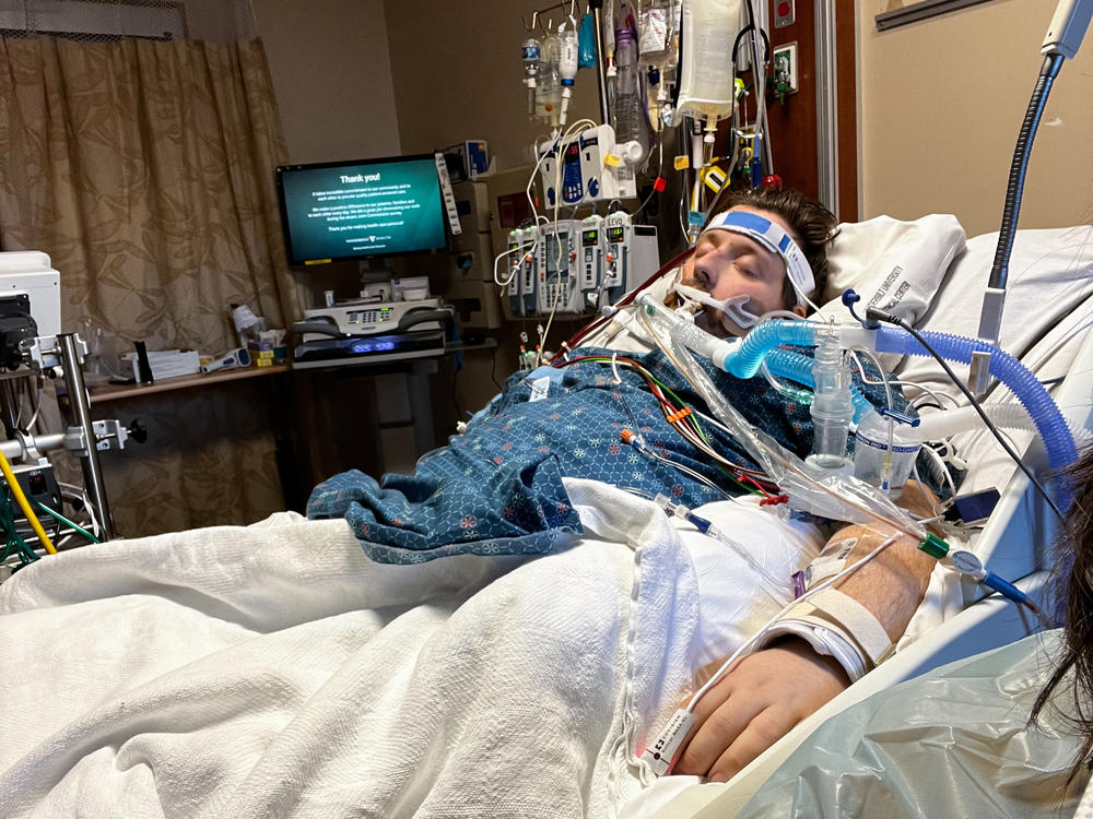 James Perkinson of Greenbriar, Tenn., underwent ECMO for nearly two months while he was sedated. He says without the 