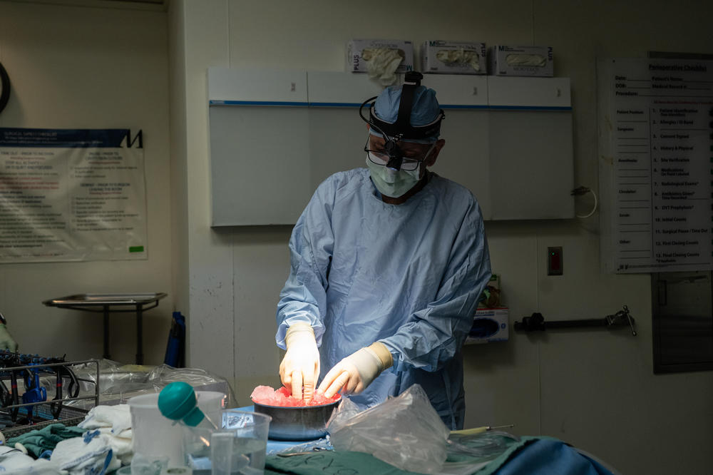 Dr. Gaber cleans up an extracted kidney from Michael Wingard.