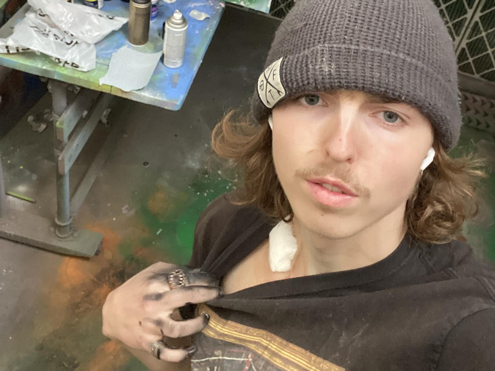 Less than 24 hours after having a tube inserted into his heart, Chivers was back to work on a sculpture for school.