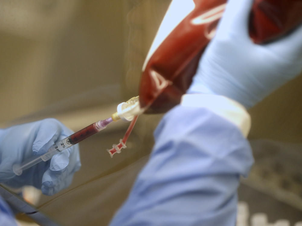 The average donation requires 2 pints of stem cells, which is dark red in color and is similar to a blood donation.