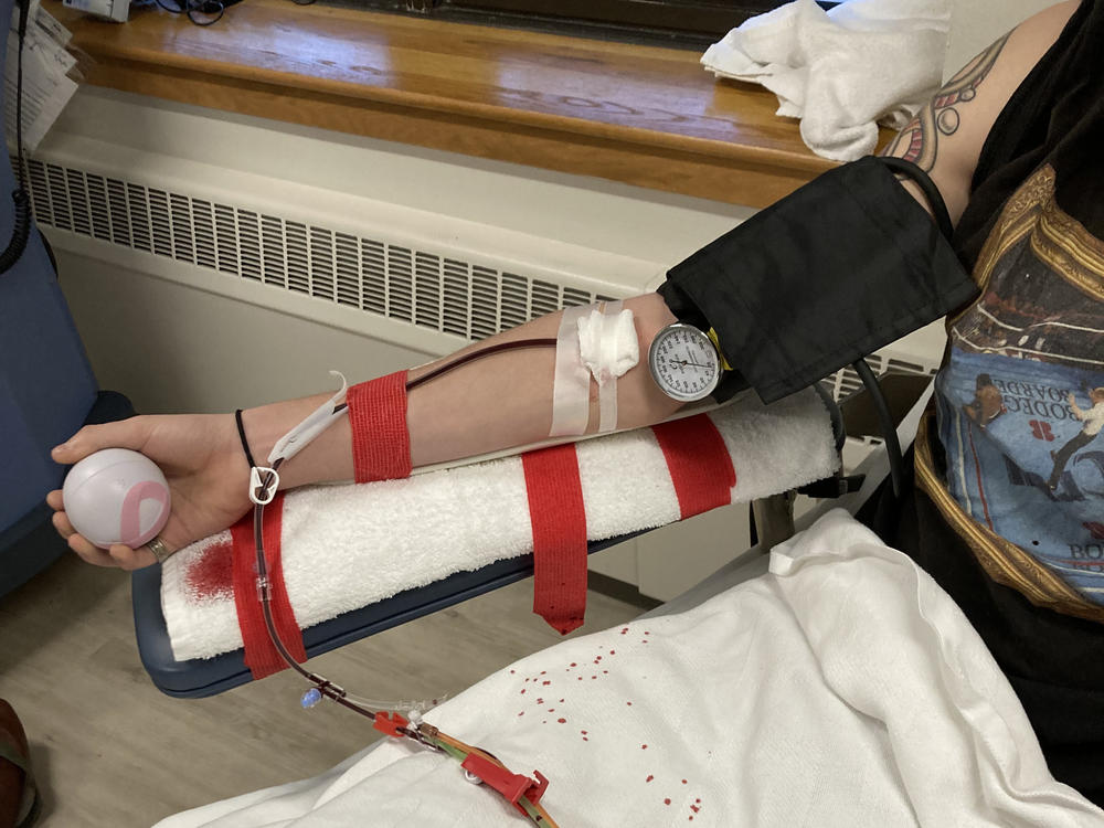 The initial procedure involved an IV in each of Mick Chivers' arms, but veins in his right side refused to take the needle over 13 attempts. As a result, the nurses had to consider more invasive options.