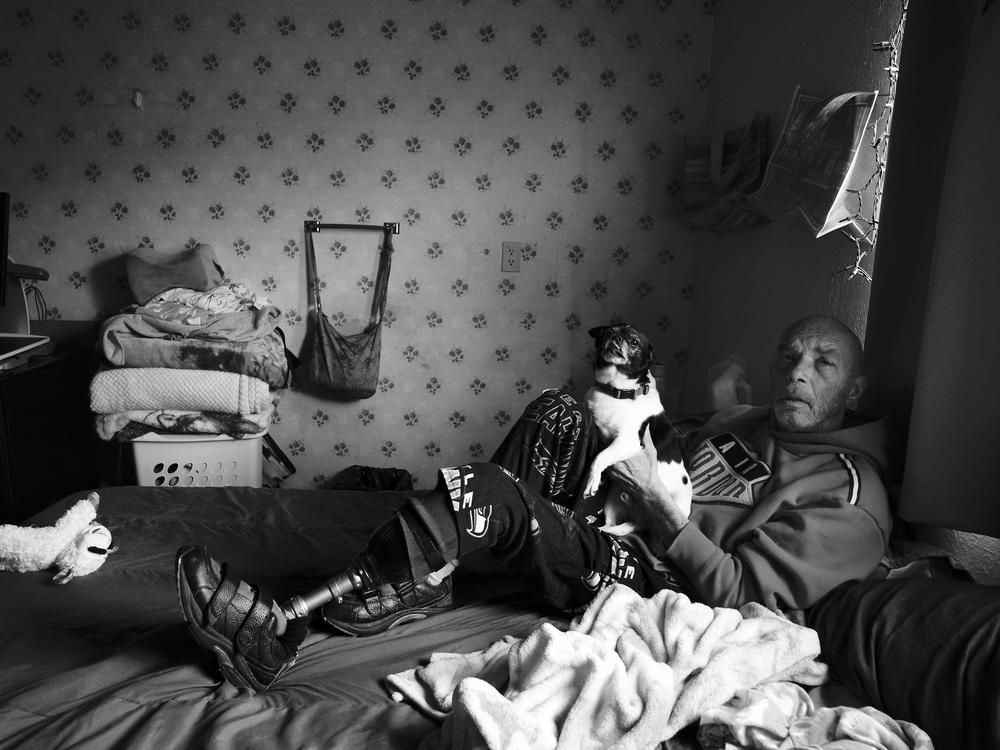 Tony Johnson sits on his bed with his dog, Dash, in the one-room home he shares with his wife, Karen Johnson, in a care facility in Burlington, Wash. on April 13, 2022. Johnson was one of the first people to get COVID-19 in Washington state in April of 2020. His left leg had to be amputated due to lack of wound care after he developed blood clots in his feet while on a ventilator.