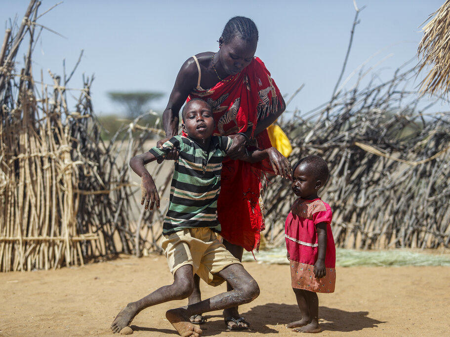A mother helps her malnourished son stand after he collapsed near their hut in the village of Lomoputh in northern Kenya on Thursday. A severe drought and spiking food prices are causing a humanitarian emergency in the Horn of Africa.