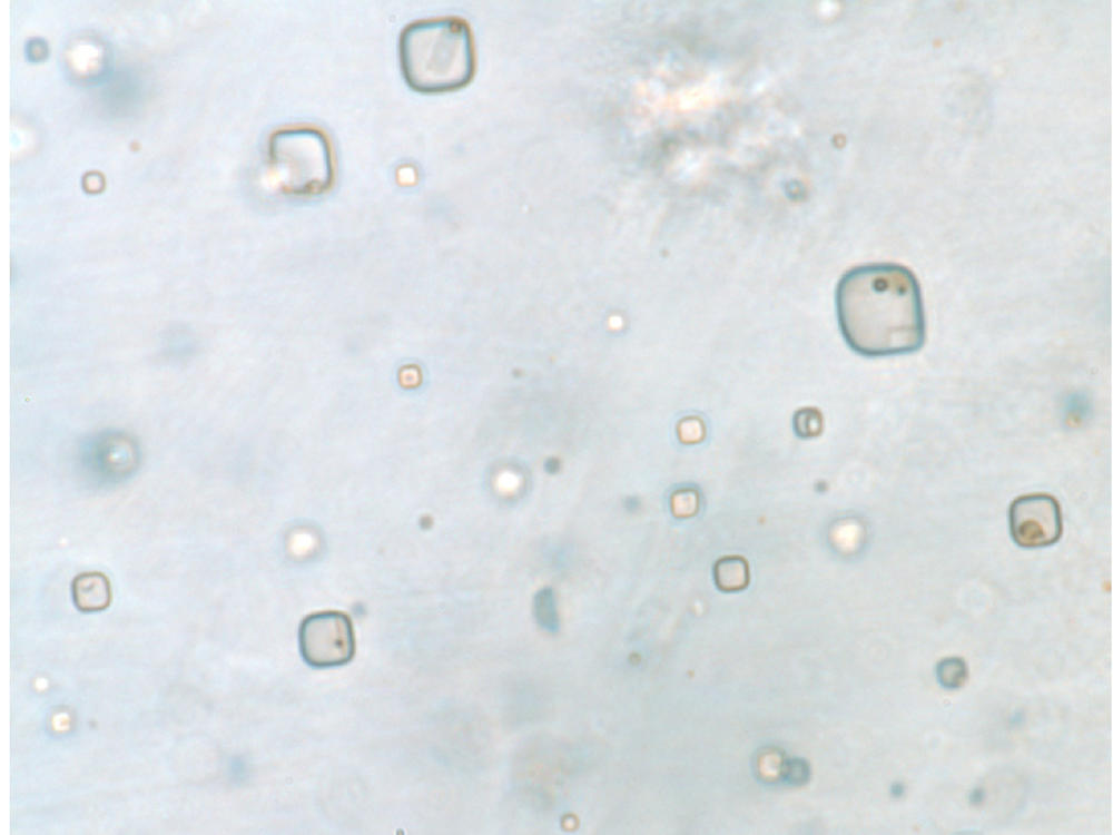 The shapes in this salt crystal are consistent with what would be expected for microorganisms.