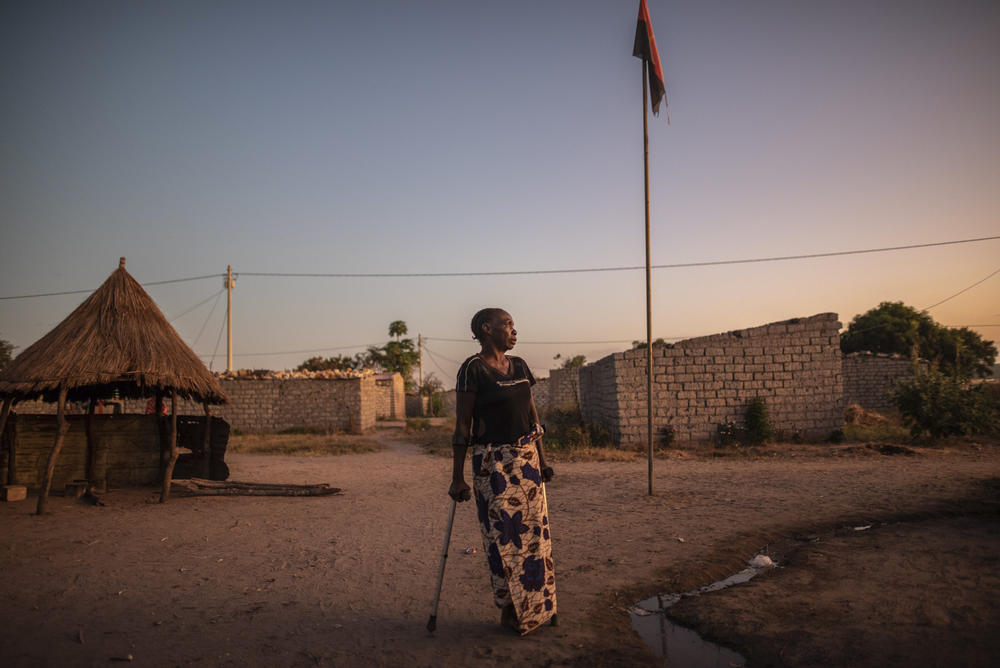 Donisa Motango Katanga stands in her home village of Samaria, Angola. Donisa stepped on a landmine while returning from her fields and lost her left leg. She is one of several residents in the village who have been injured or killed by landmines.