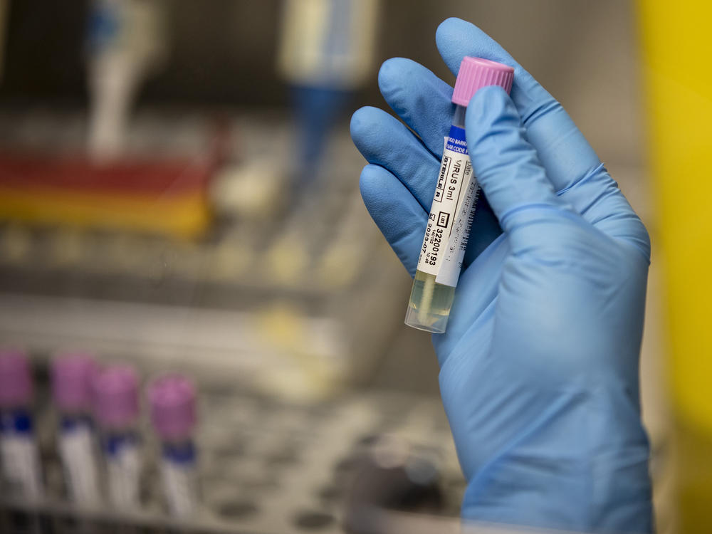 A medical technician shows a suspected monkeypox sample at the microbiology laboratory of La Paz Hospital on June 6 in Madrid. The World Health Organization is working with experts on changing the name of the virus.
