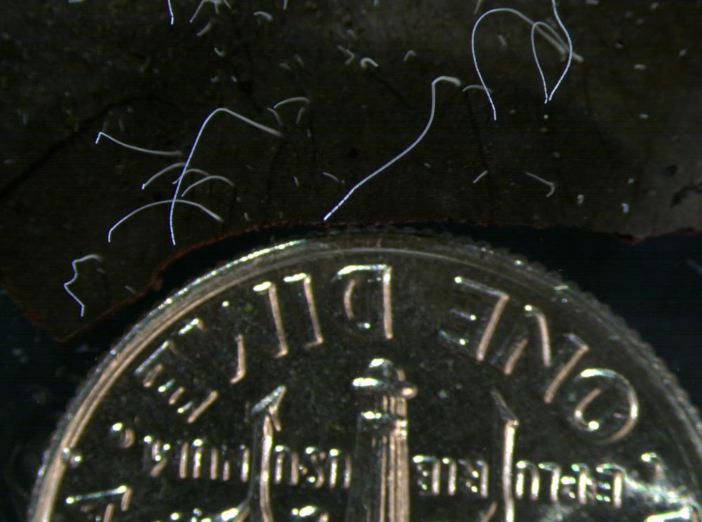 The bacteria, shown here next to a dime, are close to the size of human eyelashes.