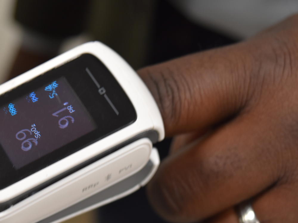 A pulse oximeter is worn by Brown University professor Kimani Toussaint. The devices have been shown in research to produce inaccurate results in dark-skinned people, and Toussaint's lab is developing technology that would be more accurate, regardless of skin tone.