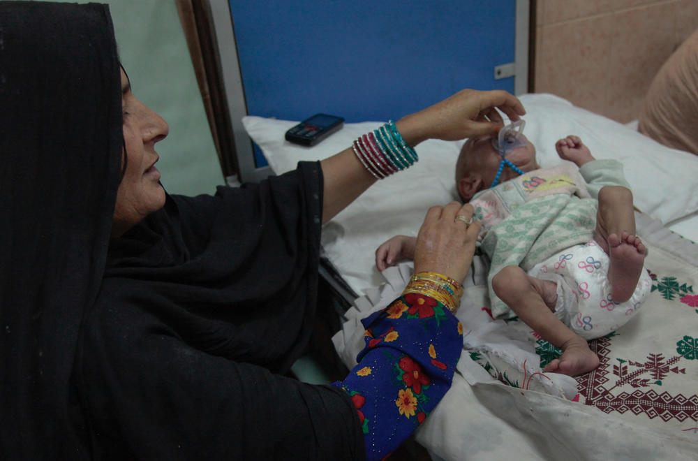 A mother tries to sooth her baby in a ward in the Indira Gandhi hospital in Kabul where babies are treated for malnutrition. Afghanistan's longstanding problems with hunger and malnutrition have dramatically escalated since the Taliban seized power last August.