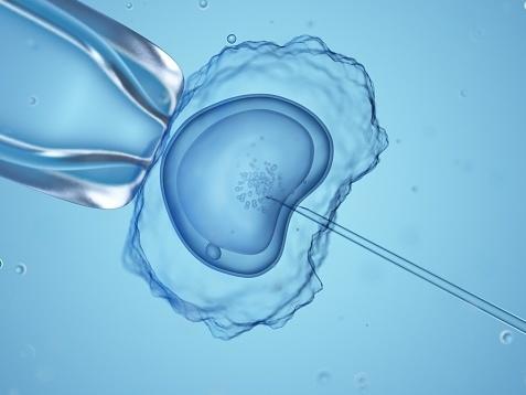 In states that outlaw abortion, some patients and health care workers worry that in vitro fertilization could be in legal jeopardy too.
