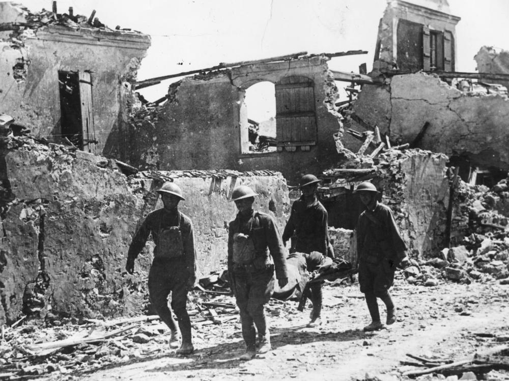 Four American soldiers carry a wounded soldier on a stretcher in Vaux, France, on July 22, 1918. As many as 280,000 World War I combatants were left with facial injuries.