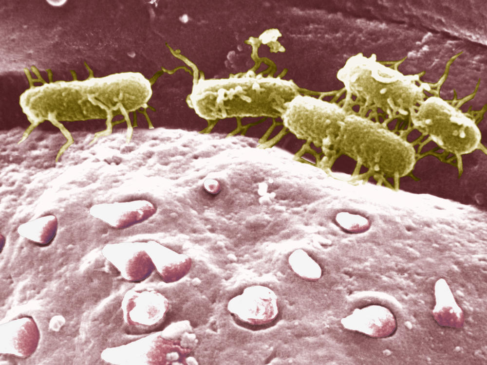 Scanning electron micrograph of <em data-stringify-type=