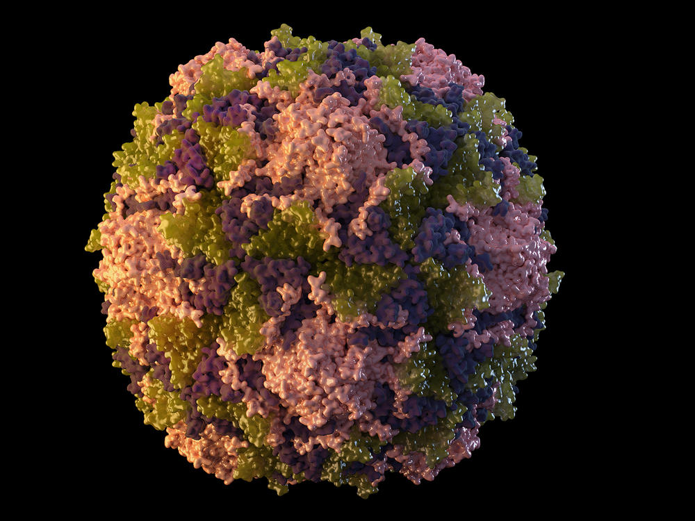 New York health officials detected Polio in a patient Thursday, the first case in the United States since 2013. The signature symptom of the Polio virus is paralysis, which can return later in life, years after a survivor has recovered from their initial infection.