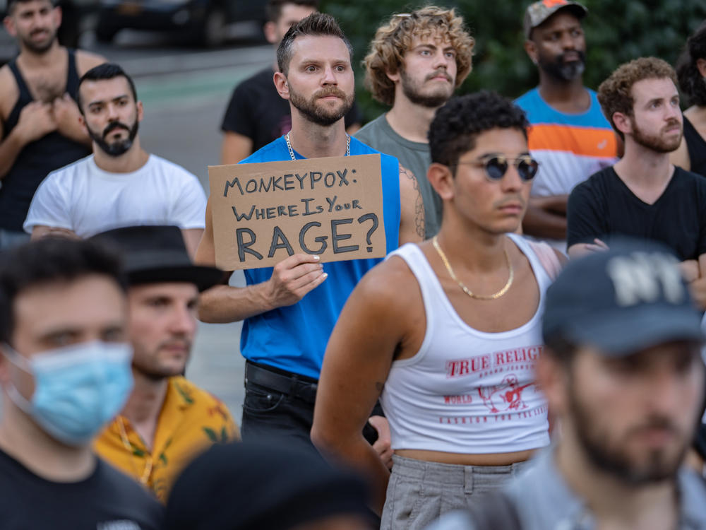 People protest during a rally calling for more government action to combat the spread of monkeypox at Foley Square on July 21, 2022 in New York City.
