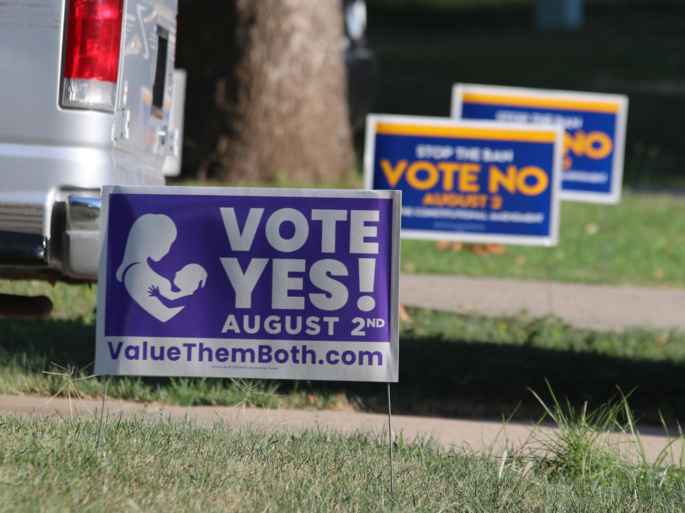 Political signs for the state constitutional amendment vote on abortion rights in Kansas sit near each other in yards in Overland Park, Kan., July 16, 2022.