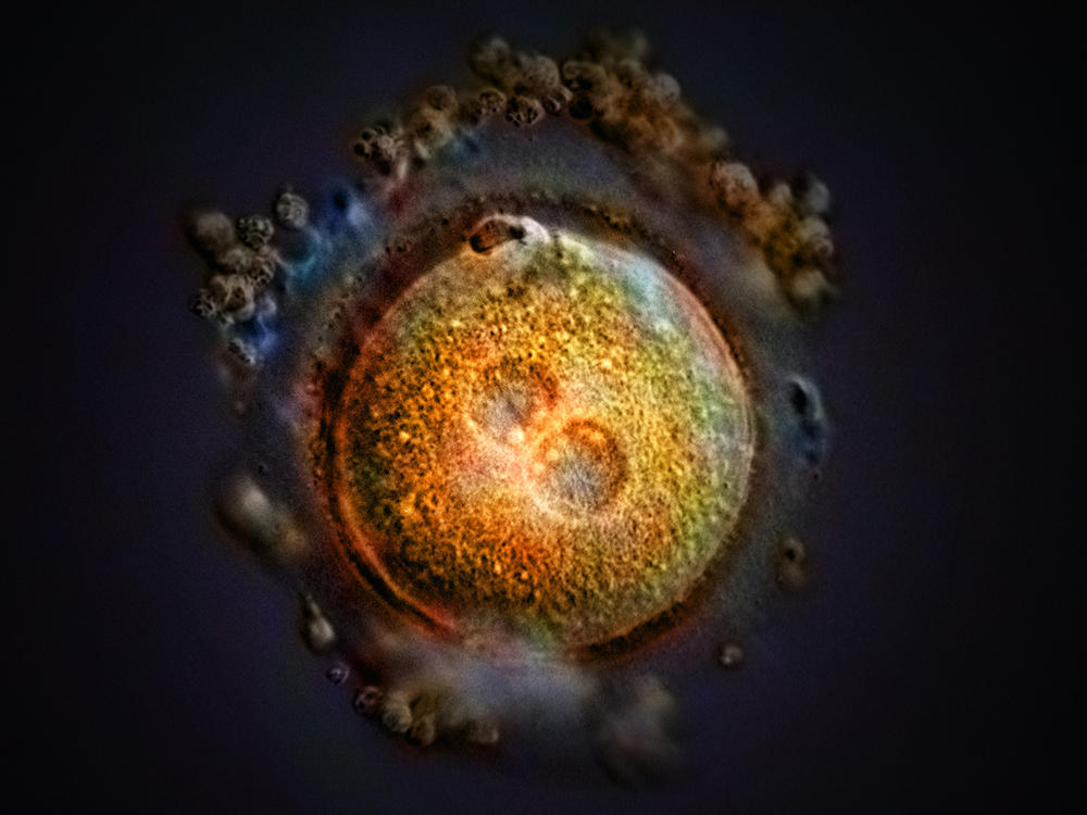 This computer-generated image shows the formation of a zygote after fertilization. Some Republican-led states, including Arkansas, Kentucky, Missouri, and Oklahoma, have passed laws declaring that life begins at fertilization, a contention that opens the door to a host of pregnancy-related litigation.