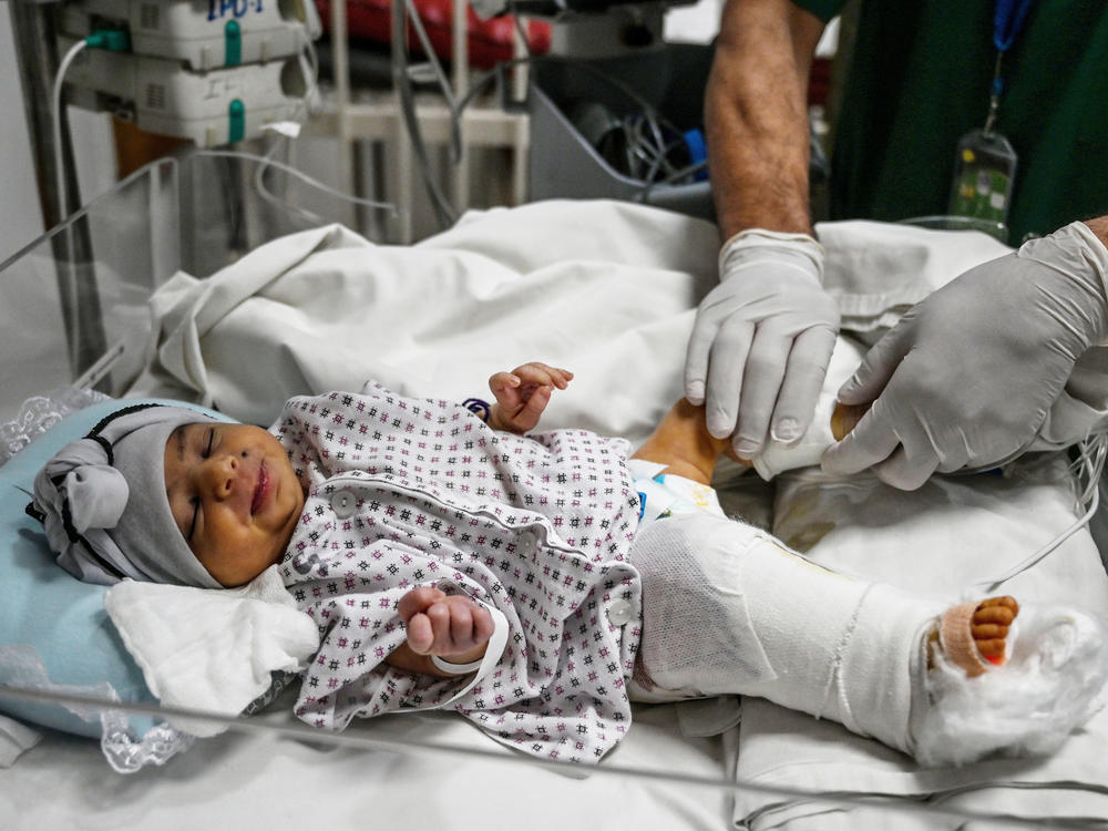 Newborn baby Amina is treated for the gun wound in her right leg incurred during the May 12, 2020 attack on a maternity hospital in Kabul. After being rescued, she was brought to the French Medical Institute for Children for surgery.