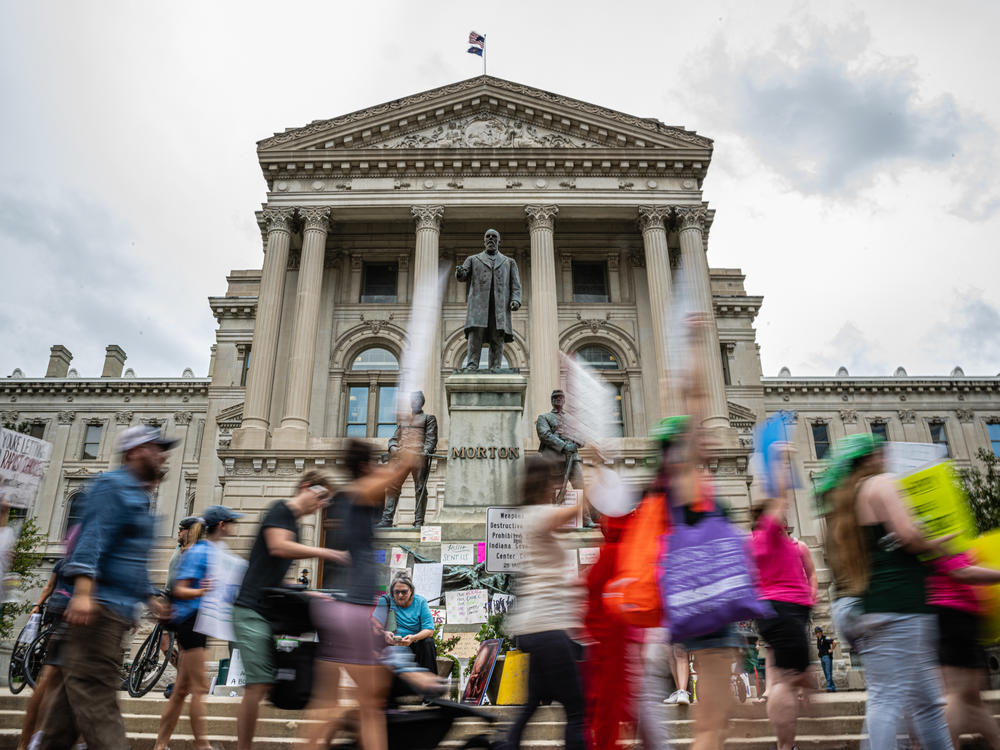 The first abortion ban passed after Roe takes effect Thursday in Indiana |  Georgia Public Broadcasting