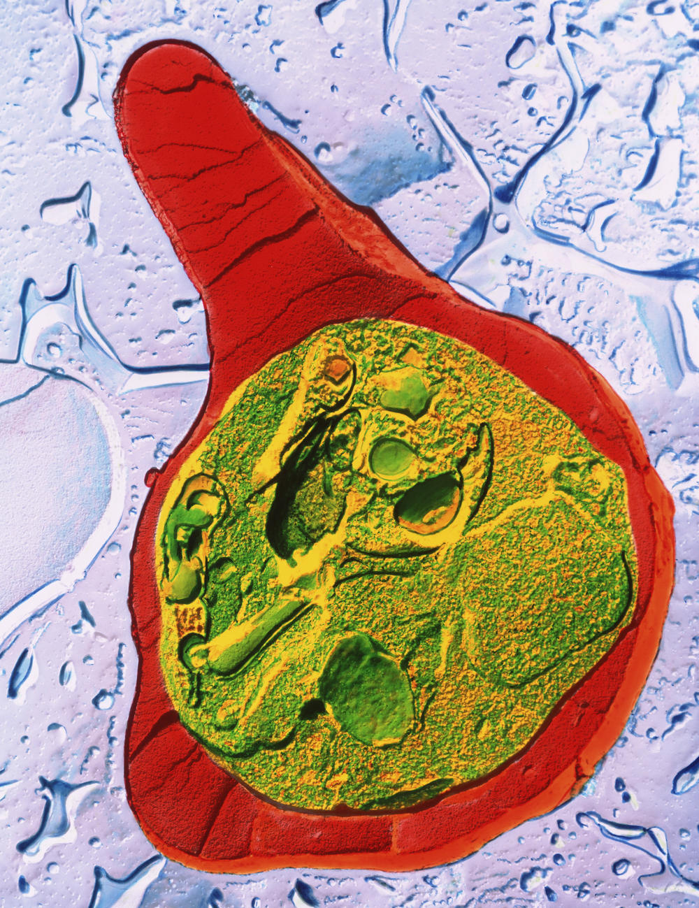 A colored microscope image of the malaria parasite, <em data-stringify-type=