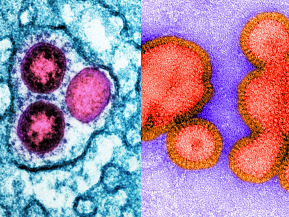 Health officials are predicting this winter could see an active flu season on top of potential COVID surges. In short, it's a good year to be a respiratory virus. Left: Image of SARS-CoV-2 omicron virus particles (pink) replicating within an infected cell (teal). Right: Image of an inactive H3N2 influenza virus.