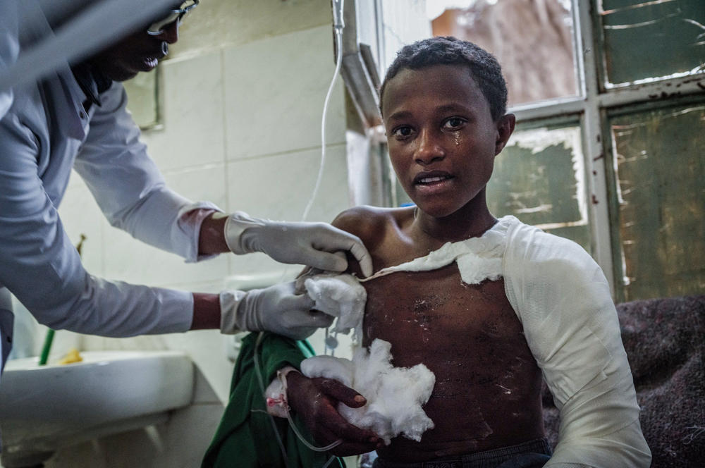 An airstrike victim is treated at Ayder Hospital in Mekele, the capital of Ethiopia's Tigray region. A blockade has kept vital medical supplies from getting to the hospital, which is barely functioning.