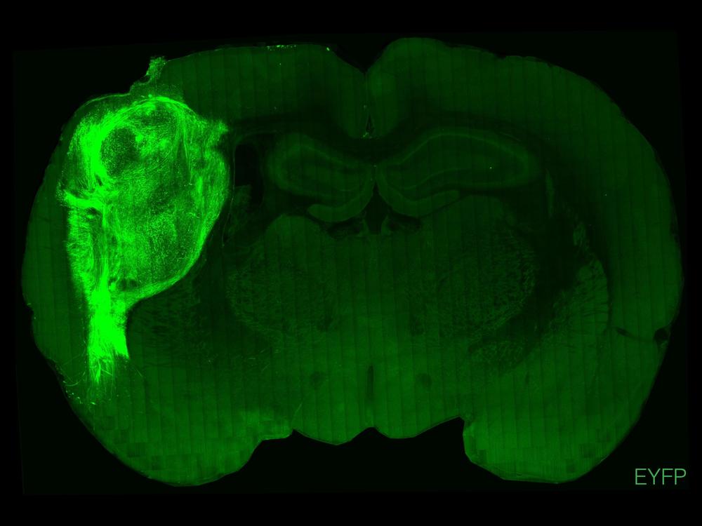 This cross-section of a rat brain shows tissue from a human brain organoid fluorescing in light green. Scientists say these implanted clusters of human neurons could aid the study of brain disorders.