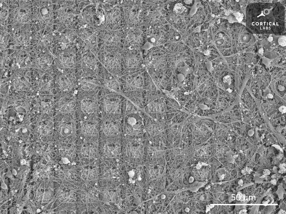 This scanning electron microscope image shows a neural culture growing on a high-density multi-electrode array. This system allowed researchers to train neurons to play the video game Pong.