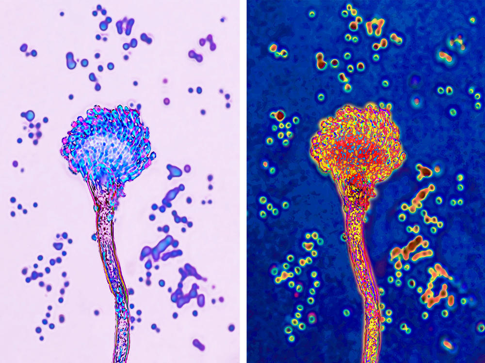 Aspergillus fumigatus can infect the lungs, causing pneumonia-like symptoms that can progress into more severe sickness.