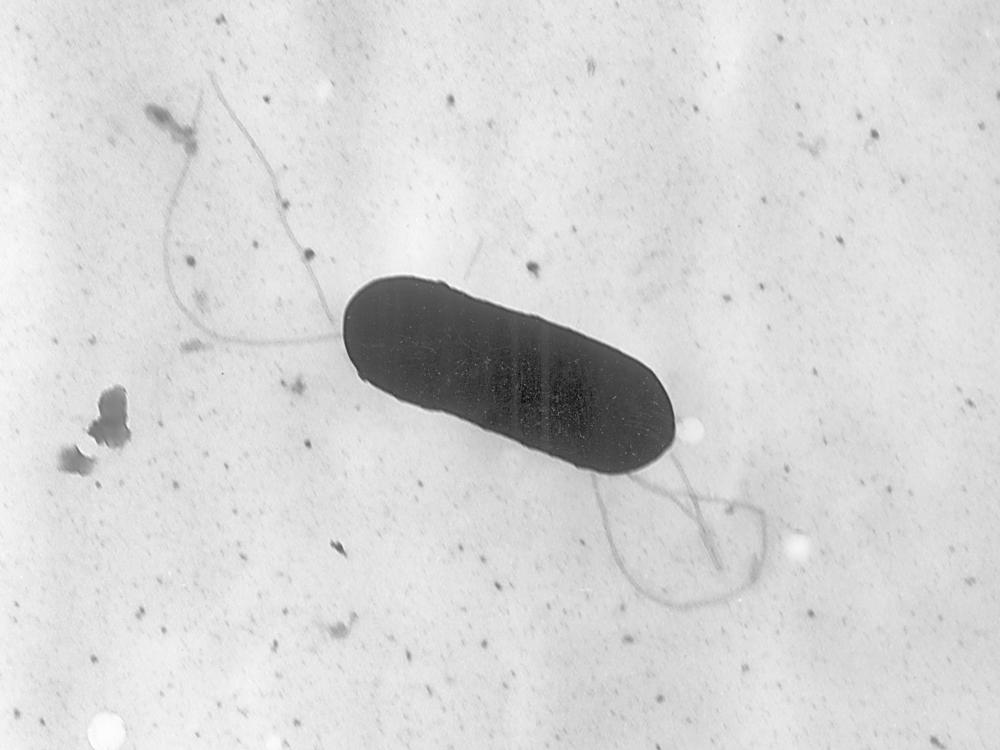 This 2002 electron microscope image made available by the Centers for Disease Control and Prevention shows a Listeria monocytogenes bacterium, responsible for the food borne illness listeriosis. On Wednesday, Nov. 9, 2022, U.S. health officials said at least one death and a pregnancy loss are tied to an outbreak of listeria food poisoning associated with sliced deli meats and cheeses.