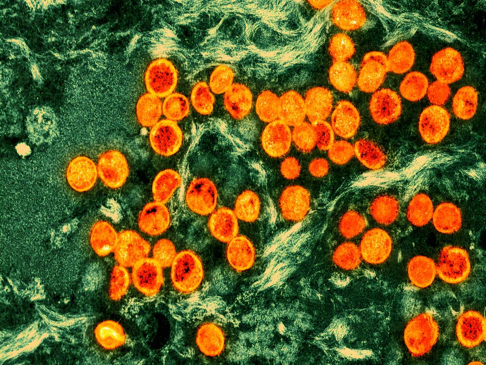 Monkeypox is getting a new name: mpox. Here, monkeypox virus particles (orange) are seen within an infected cell (green), after being cultured in a laboratory. The image was produced by a colorized transmission electron micrograph.