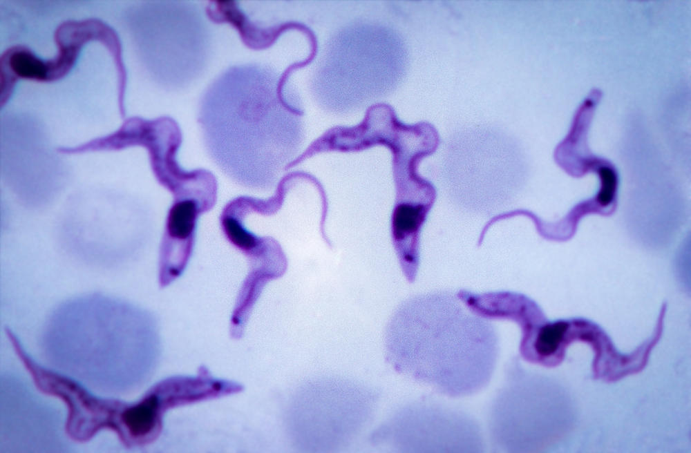 <em>Trypanosoma brucei gambiense</em>, the parasite that causes sleeping sickness, accounts for more than 95% of reported cases of sleeping sickness.