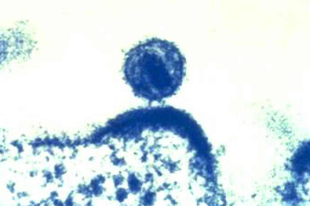 A colorized electron microscope image from the National Institute of Allergy and Infectious Diseases shows a single human immunodeficiency virus budding from a human immune cell.