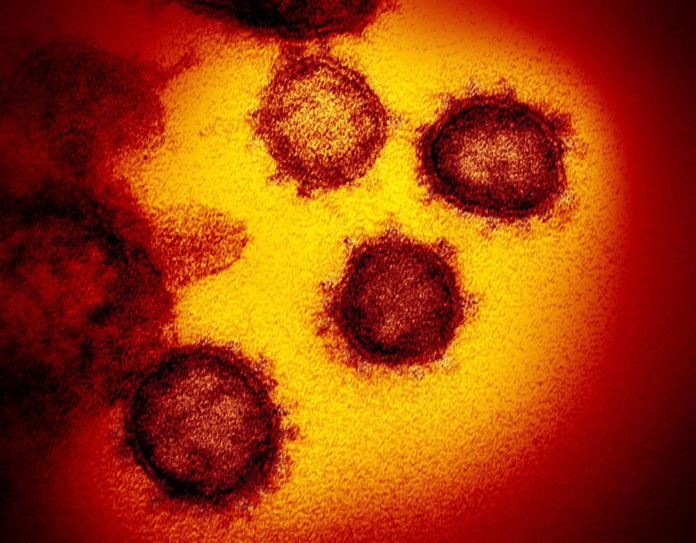 SARS-CoV-2 is shown in this colorized transmission electron micrograph. This specimen was isolated from a patient in the U.S. Particles of the virus are shown emerging from the surface of cells cultured in the lab.