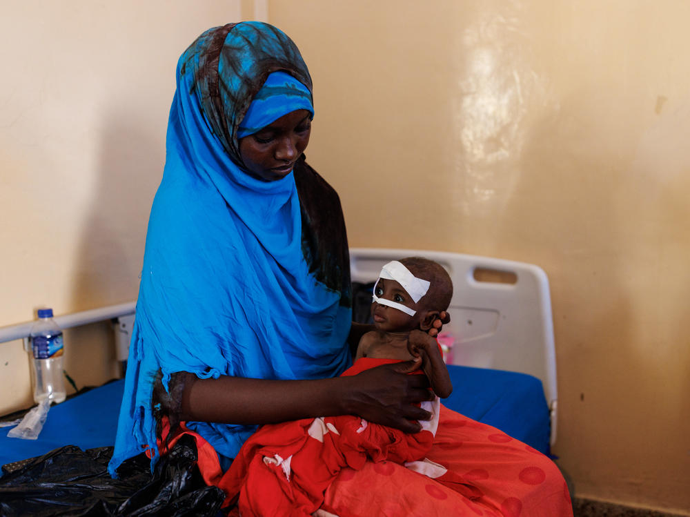 Fahir Mayow holds her nephew, eight-month-old Ahmed Noor, at Banadir Hospital in Mogadishu on Monday. Ahmed arrived at the hospital one week ago, weighing 3.5 kilograms, just under 8 pounds.