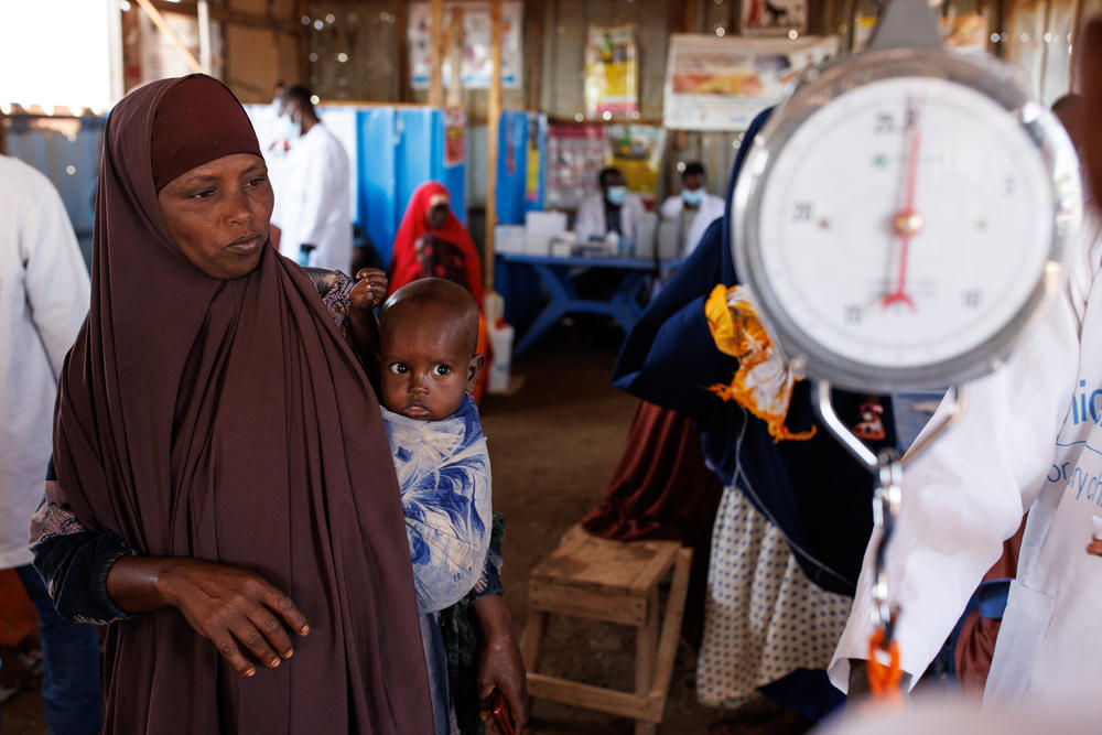 A mother waits in line for medical practitioners to weigh her child at an outpatient clinic monitoring malnutrition at a camp for displaced people in Baidoa on Wednesday.