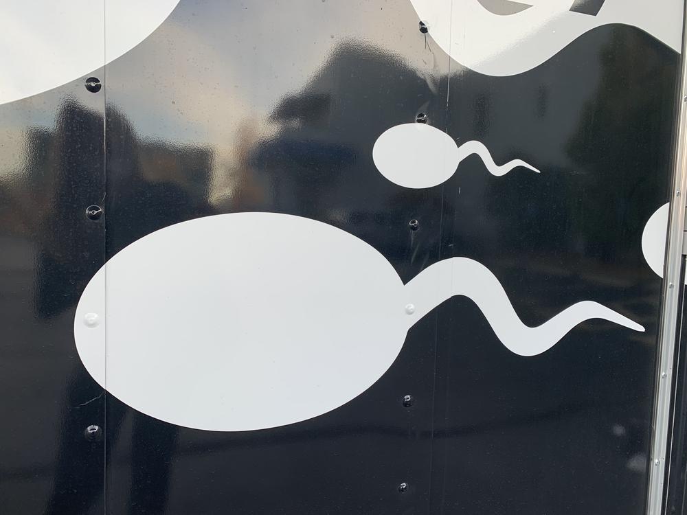 Dr. Esgar Guarín's mobile vasectomy clinic, pictured here parked at a Planned Parenthood in St. Louis, Mo., features images of sperm.