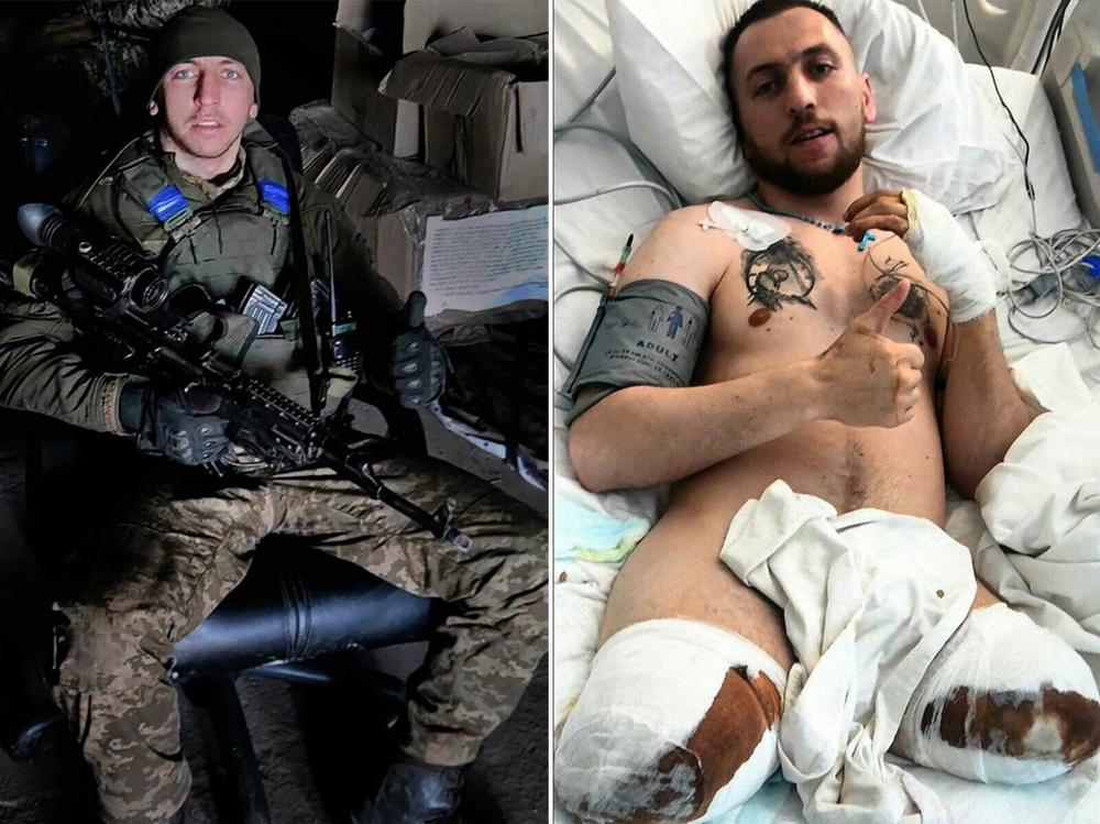 Left: Misha's cell phone photo of himself in uniform during the war. Right: A photo of Misha in a hospital after his legs were amputated.